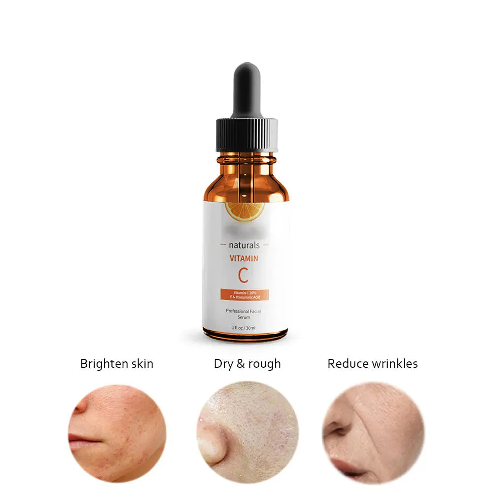 Vitamin C Dark Spot Face Serum