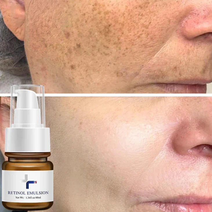 Anti-Wrinkle Essence Facial Lotion