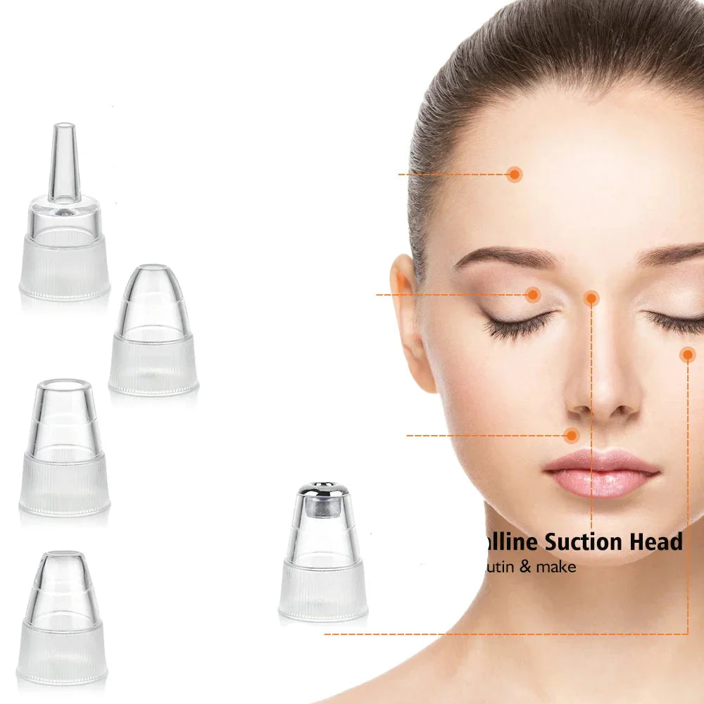 Electric Blackhead Remover